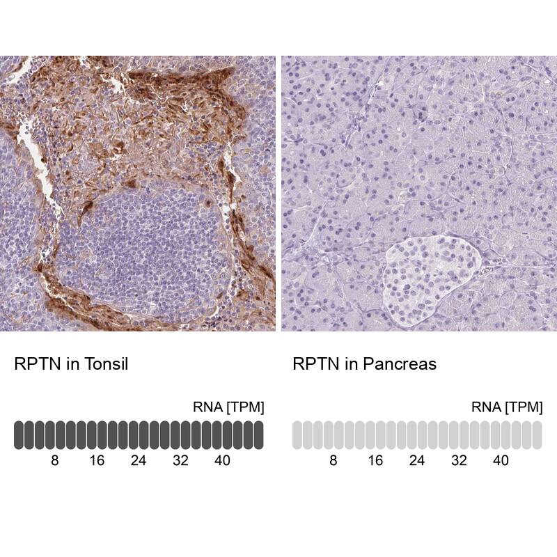RPTN Antibody - BSA Free Immunohistochemistry: RPTN Antibody - BSA Free [NBP1-93792]