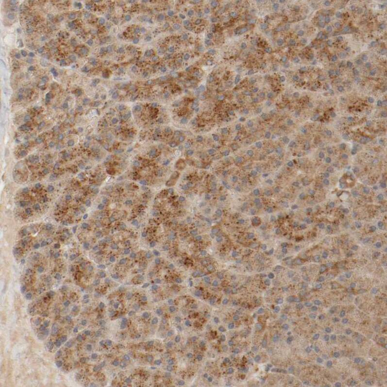 TMEM192 Antibody - BSA Free Immunohistochemistry: TMEM192 Antibody - BSA Free [NBP1-93799]