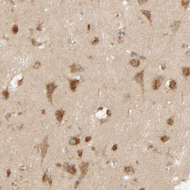 TMEM192 Antibody - BSA Free Immunohistochemistry: TMEM192 Antibody - BSA Free [NBP1-93799]