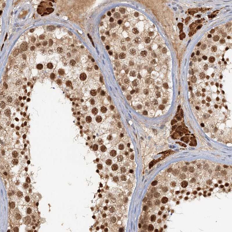 CCDC75 Antibody - BSA Free Immunohistochemistry: CCDC75 Antibody - BSA Free [NBP1-93801]
