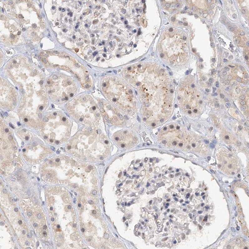 CCDC75 Antibody - BSA Free Immunohistochemistry: CCDC75 Antibody - BSA Free [NBP1-93801]