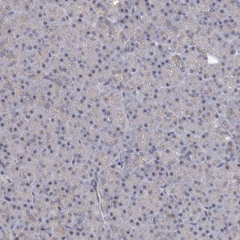 CCDC75 Antibody - BSA Free Immunohistochemistry: CCDC75 Antibody - BSA Free [NBP1-93801]