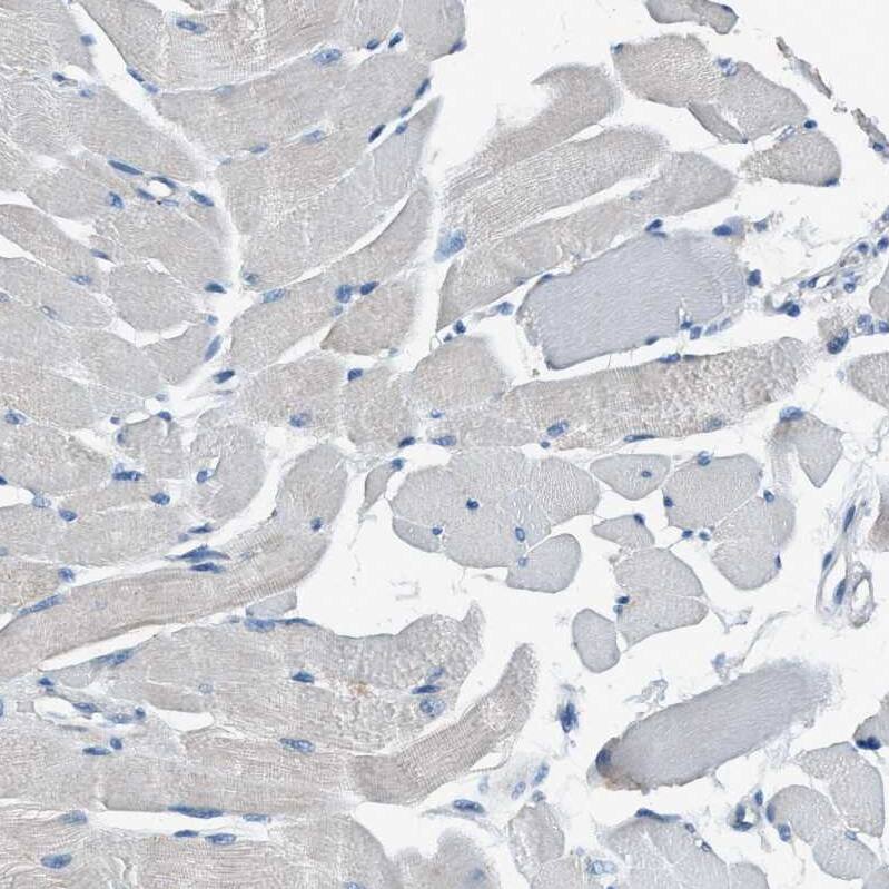 ANKFN1 Antibody - BSA Free Immunohistochemistry: ANKFN1 Antibody - BSA Free [NBP1-93803]