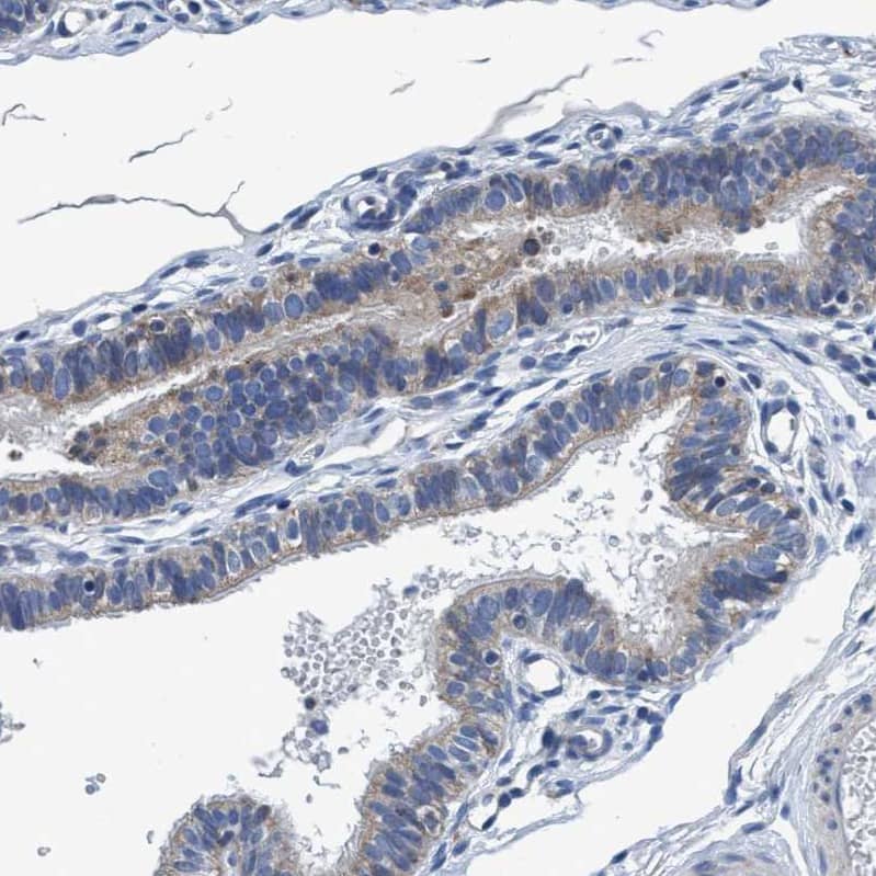 ANKFN1 Antibody - BSA Free Immunohistochemistry: ANKFN1 Antibody - BSA Free [NBP1-93803]