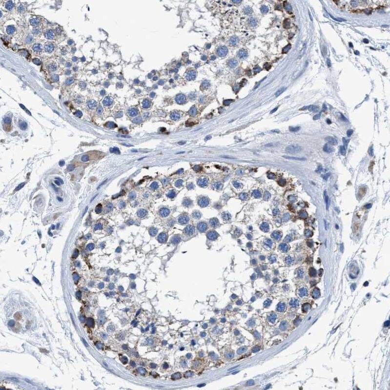 ANKFN1 Antibody - BSA Free Immunohistochemistry: ANKFN1 Antibody - BSA Free [NBP1-93803]