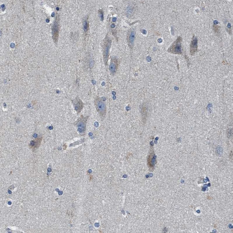 ANKFN1 Antibody - BSA Free Immunohistochemistry: ANKFN1 Antibody - BSA Free [NBP1-93803]