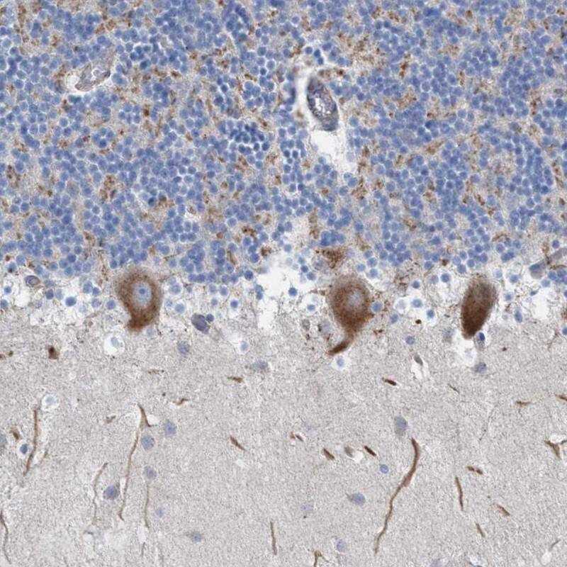 NYAP1 Antibody - BSA Free Immunohistochemistry: NYAP1 Antibody - BSA Free [NBP1-93806]