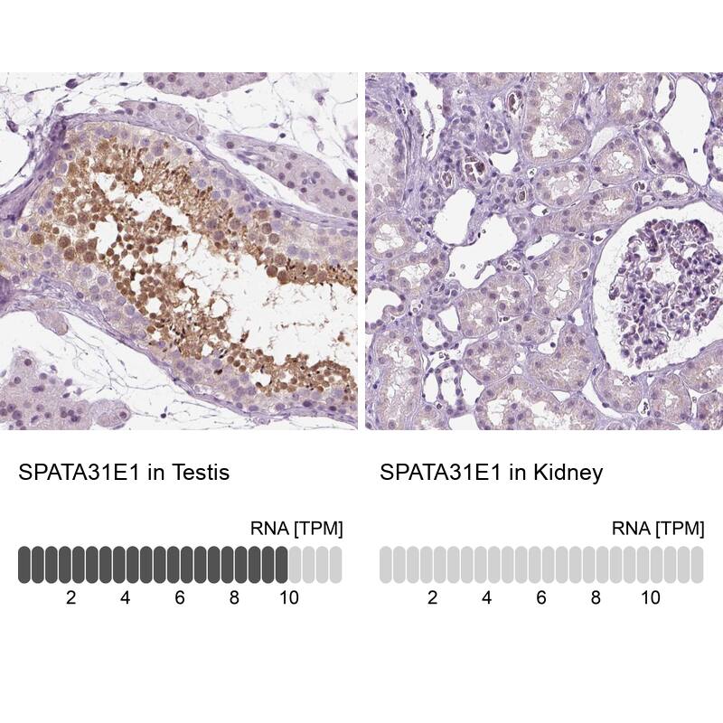 SPATA31E1 Antibody - BSA Free Immunohistochemistry-Paraffin: SPATA31E1 Antibody [NBP1-93822]
