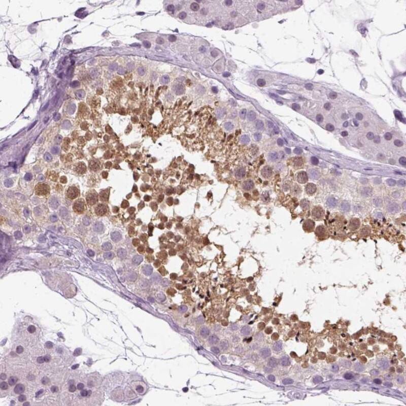 SPATA31E1 Antibody - BSA Free Immunohistochemistry-Paraffin: SPATA31E1 Antibody [NBP1-93822]