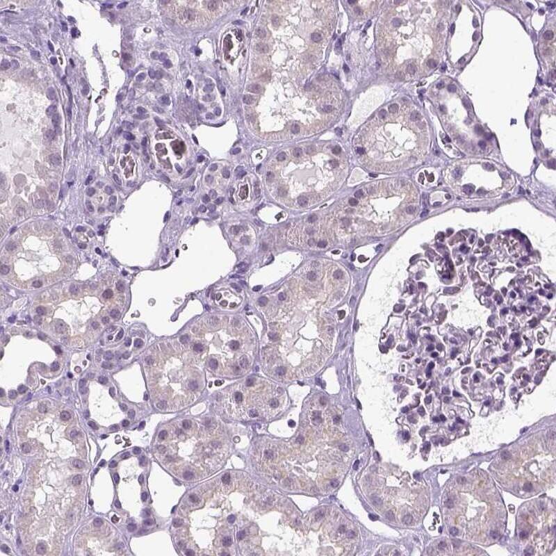 SPATA31E1 Antibody - BSA Free Immunohistochemistry-Paraffin: SPATA31E1 Antibody [NBP1-93822]