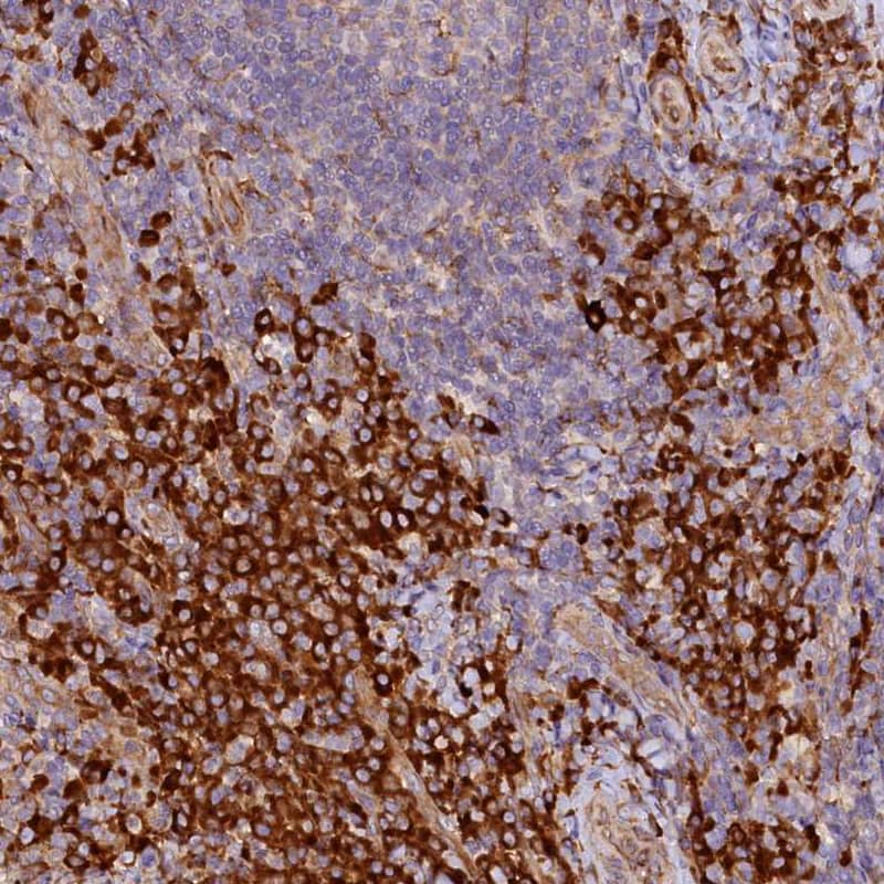 SSC5D Antibody - BSA Free Immunohistochemistry: SSC5D Antibody - BSA Free [NBP1-93831]