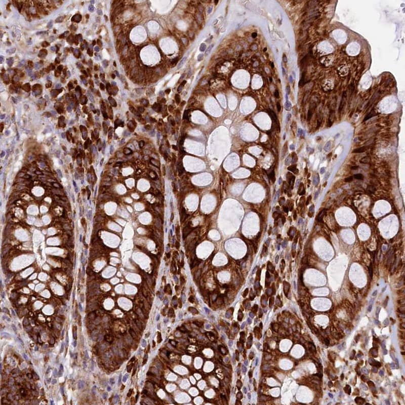 SSC5D Antibody - BSA Free Immunohistochemistry: SSC5D Antibody - BSA Free [NBP1-93831]