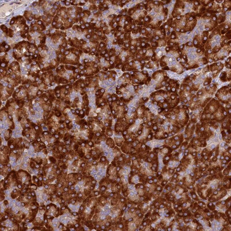 SSC5D Antibody - BSA Free Immunohistochemistry: SSC5D Antibody - BSA Free [NBP1-93831]