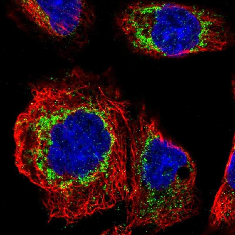 FAM73A Antibody - BSA Free Immunocytochemistry/ Immunofluorescence: FAM73A Antibody [NBP1-93832]