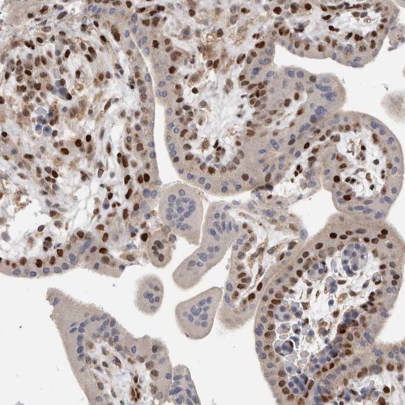 C8orf58 Antibody - BSA Free Immunohistochemistry: C8orf58 Antibody - BSA Free [NBP1-93835]