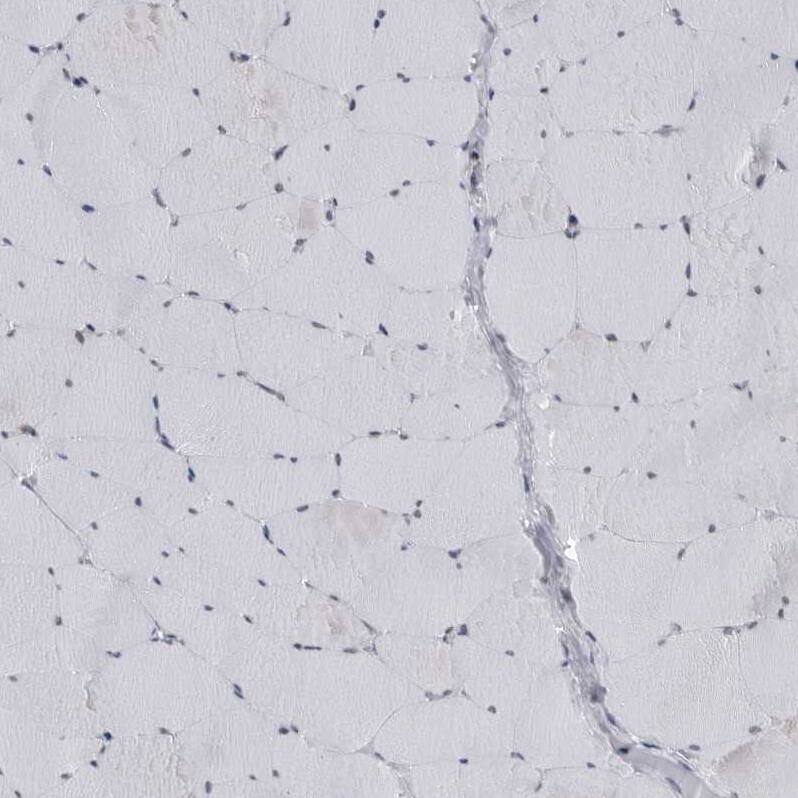 C8orf58 Antibody - BSA Free Immunohistochemistry: C8orf58 Antibody - BSA Free [NBP1-93836]