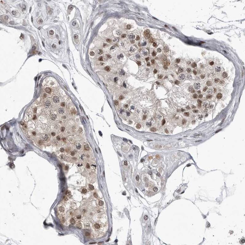 C8orf58 Antibody - BSA Free Immunohistochemistry: C8orf58 Antibody - BSA Free [NBP1-93836]