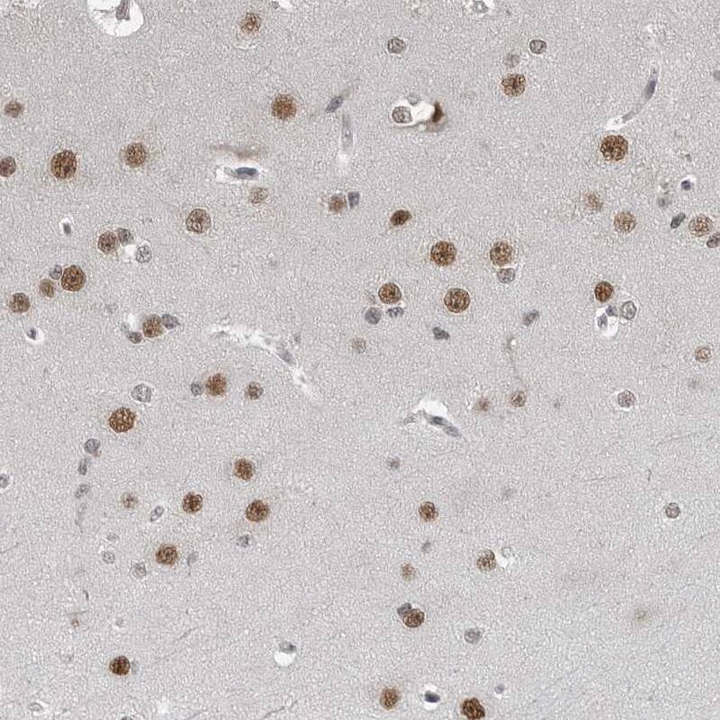 C8orf58 Antibody - BSA Free Immunohistochemistry: C8orf58 Antibody - BSA Free [NBP1-93836]