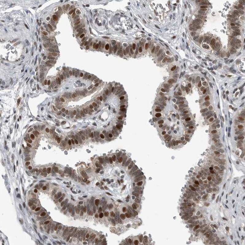 C8orf58 Antibody - BSA Free Immunohistochemistry: C8orf58 Antibody - BSA Free [NBP1-93836]