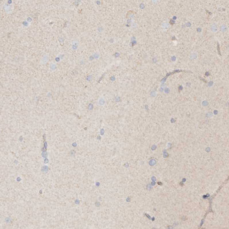 Keratinocyte Differentiation Factor 1 Antibody - BSA Free Immunohistochemistry: Keratinocyte Differentiation Factor 1 Antibody - BSA Free [NBP1-93838]