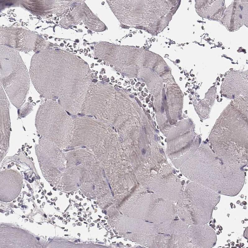 SPAG17 Antibody - BSA Free Immunohistochemistry: SPAG17 Antibody - BSA Free [NBP1-93840]