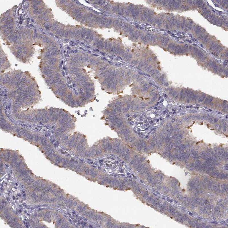 SPAG17 Antibody - BSA Free Immunohistochemistry: SPAG17 Antibody - BSA Free [NBP1-93840]