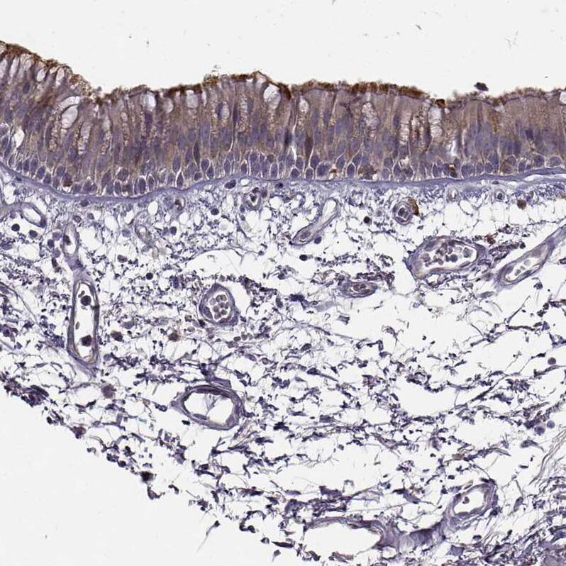 SPAG17 Antibody - BSA Free Immunohistochemistry: SPAG17 Antibody - BSA Free [NBP1-93840]