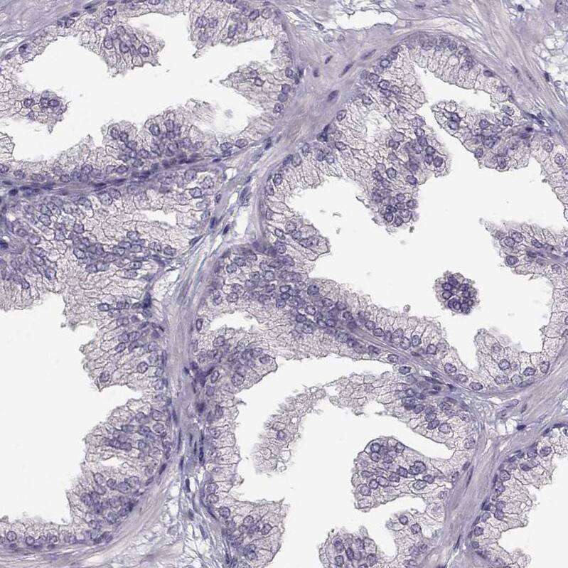 SPAG17 Antibody - BSA Free Immunohistochemistry: SPAG17 Antibody - BSA Free [NBP1-93841]