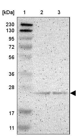 PDDC1 Antibody - BSA Free Western Blot: PDDC1 Antibody - BSA Free [NBP1-93843]