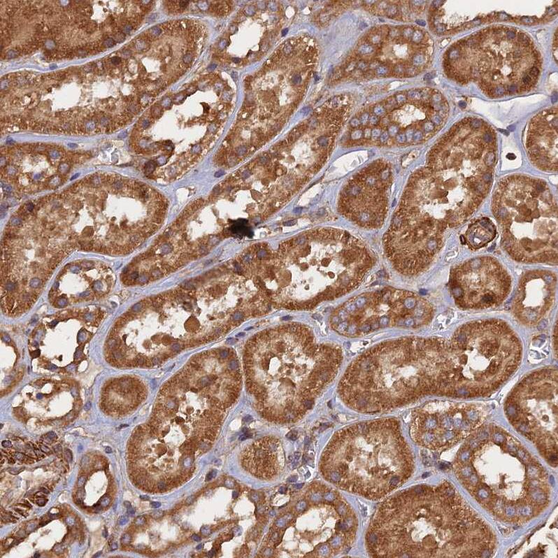 KIAA1468 Antibody - BSA Free Immunohistochemistry: KIAA1468 Antibody - BSA Free [NBP1-93851]