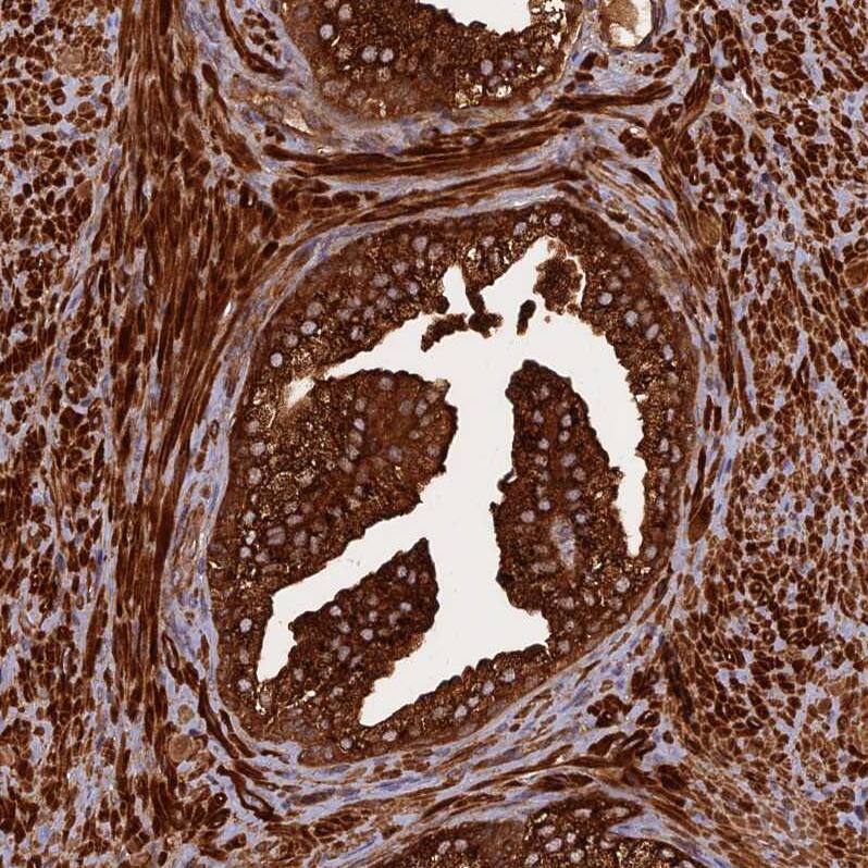 KIAA1468 Antibody - BSA Free Immunohistochemistry: KIAA1468 Antibody - BSA Free [NBP1-93851]