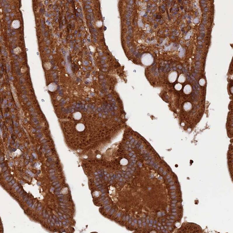 KIAA1468 Antibody - BSA Free Immunohistochemistry: KIAA1468 Antibody - BSA Free [NBP1-93851]