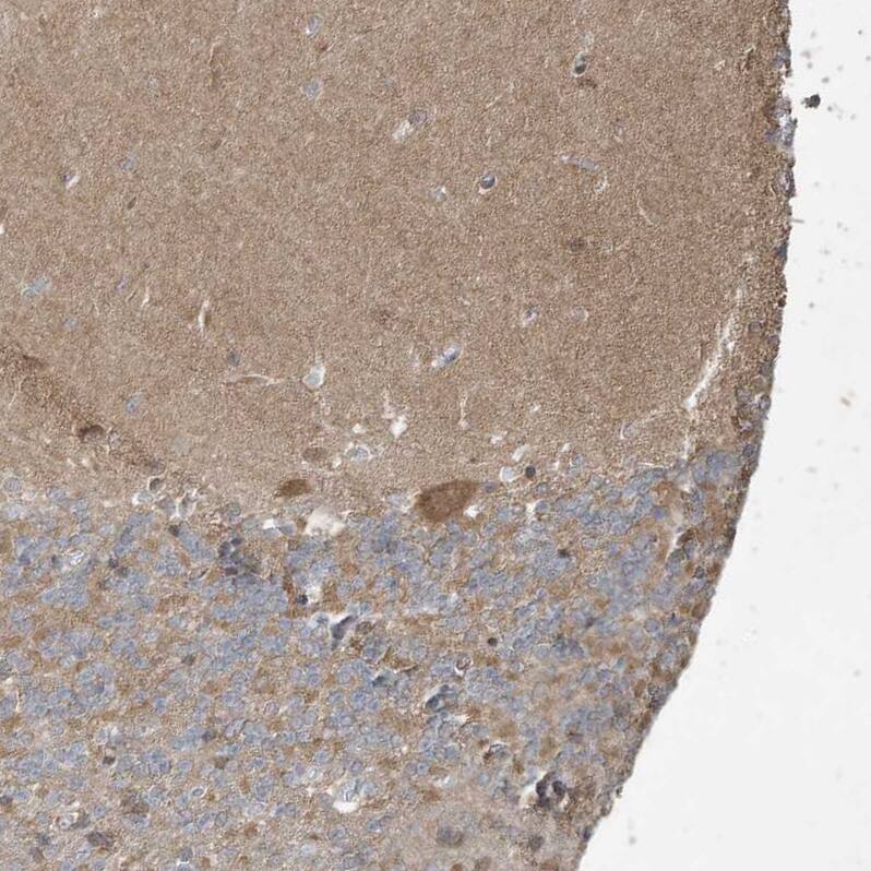 PRRT3 Antibody - BSA Free Immunohistochemistry: PRRT3 Antibody - BSA Free [NBP1-93853]