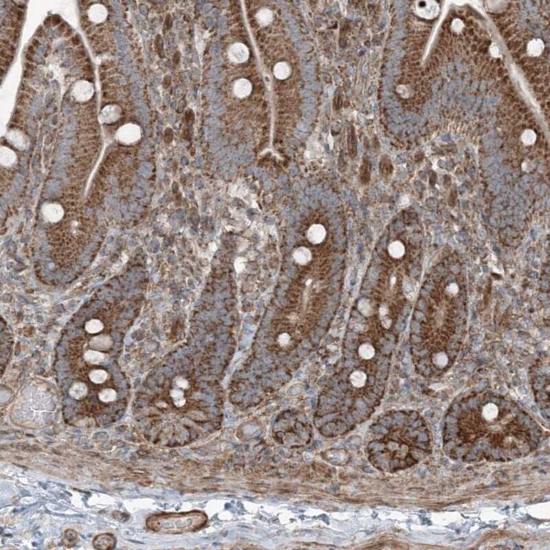 KY Antibody - BSA Free Immunohistochemistry: KY Antibody - BSA Free [NBP1-93859]
