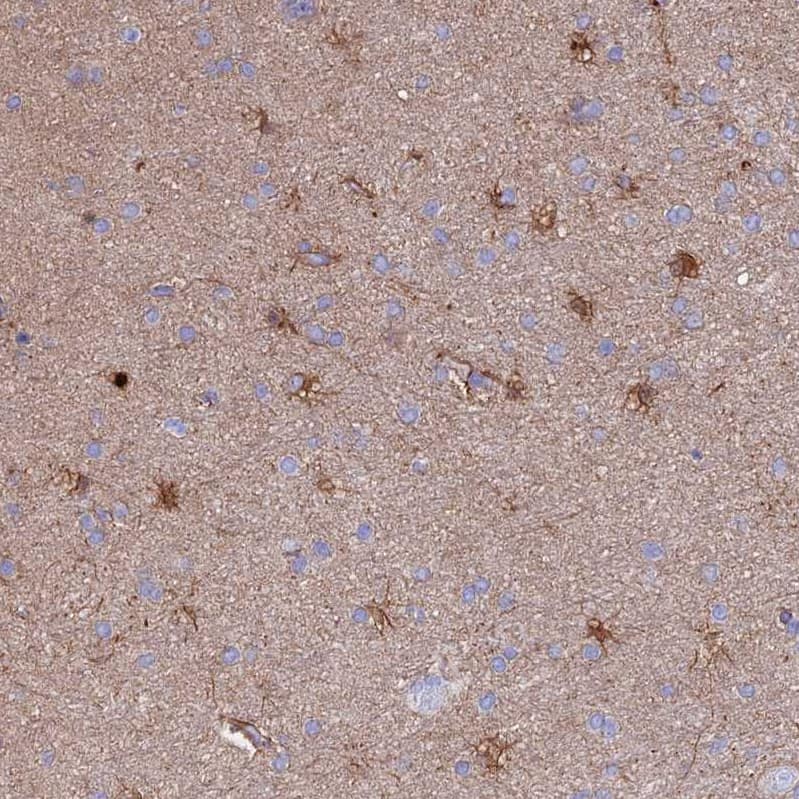 CLEC2L Antibody - BSA Free Immunohistochemistry: CLEC2L Antibody - BSA Free [NBP1-93861]