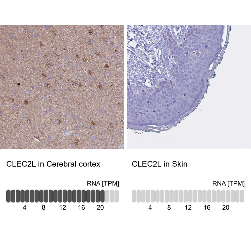 CLEC2L Antibody - BSA Free Immunohistochemistry: CLEC2L Antibody - BSA Free [NBP1-93861]