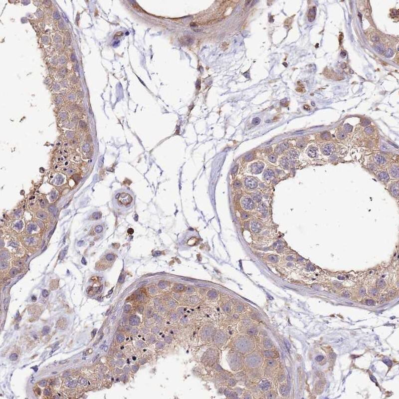 WDR64 Antibody - BSA Free Immunohistochemistry: WDR64 Antibody - BSA Free [NBP1-93862]