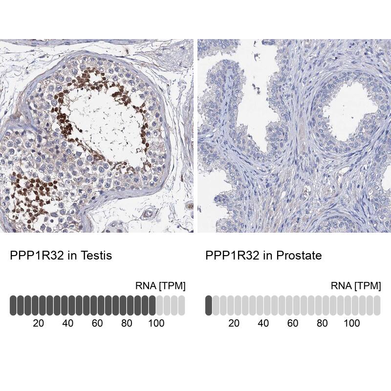 PPP1R32 Antibody - BSA Free Immunohistochemistry: PPP1R32 Antibody - BSA Free [NBP1-93873]
