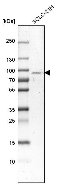 SCLT1 Antibody - BSA Free Western Blot: SCLT1 Antibody - BSA Free [NBP1-93891]