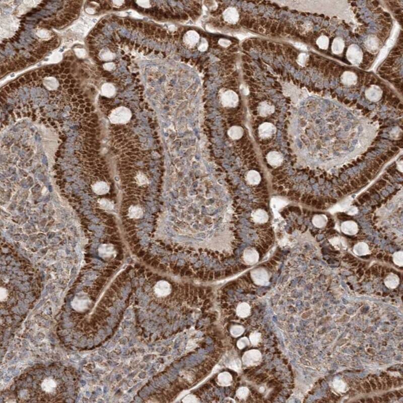 SCLT1 Antibody - BSA Free Immunohistochemistry: SCLT1 Antibody - BSA Free [NBP1-93891]