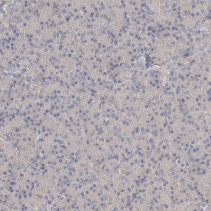 C8orf37 Antibody - BSA Free Immunohistochemistry: C8orf37 Antibody - BSA Free [NBP1-93892]