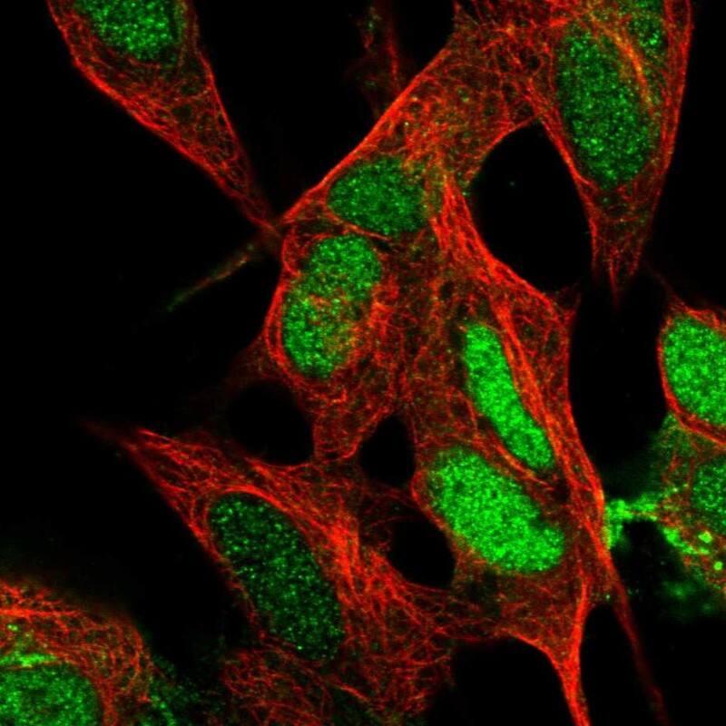 ARHGAP36 Antibody - BSA Free Immunocytochemistry/ Immunofluorescence: ARHGAP36 Antibody [NBP1-93894]