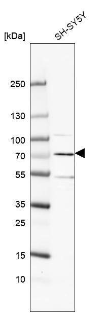ARHGAP36 Antibody - BSA Free Western Blot: ARHGAP36 Antibody - BSA Free [NBP1-93894]