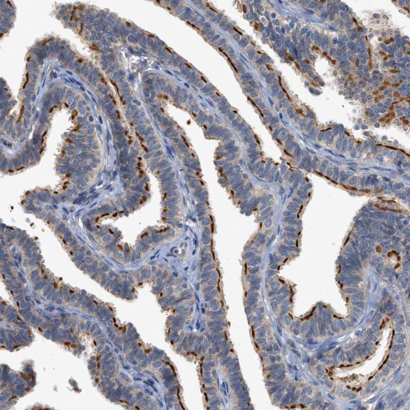 CTXN1 Antibody - BSA Free Immunohistochemistry: CTXN1 Antibody - BSA Free [NBP1-93897]