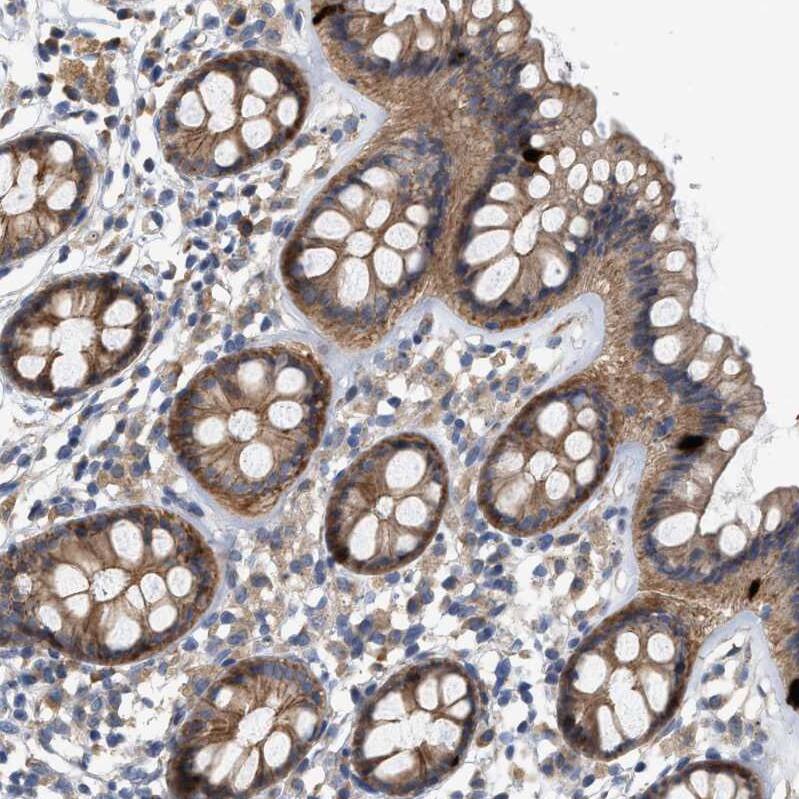 CTXN1 Antibody - BSA Free Immunohistochemistry: CTXN1 Antibody - BSA Free [NBP1-93897]
