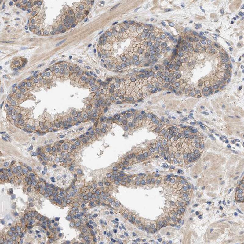 CTXN1 Antibody - BSA Free Immunohistochemistry: CTXN1 Antibody - BSA Free [NBP1-93897]