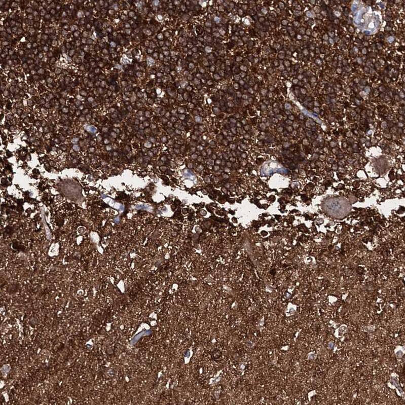 FAM123A Antibody - BSA Free Immunohistochemistry: FAM123A Antibody - BSA Free [NBP1-93907]