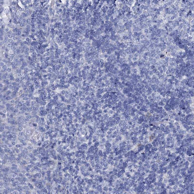 FAM123A Antibody - BSA Free Immunohistochemistry: FAM123A Antibody - BSA Free [NBP1-93907]