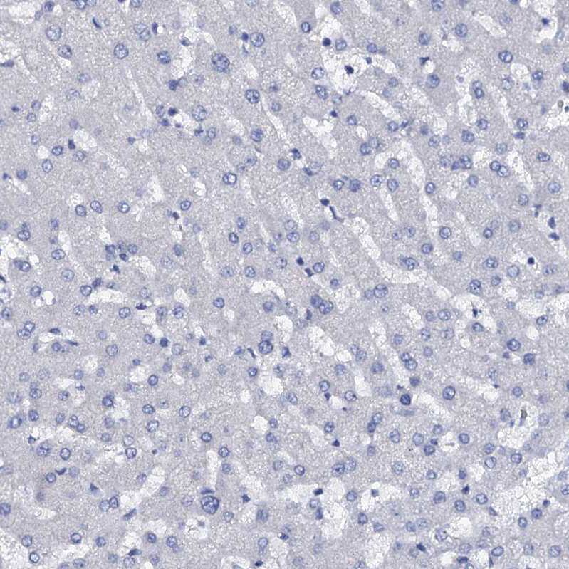 FAM123A Antibody - BSA Free Immunohistochemistry: FAM123A Antibody - BSA Free [NBP1-93907]