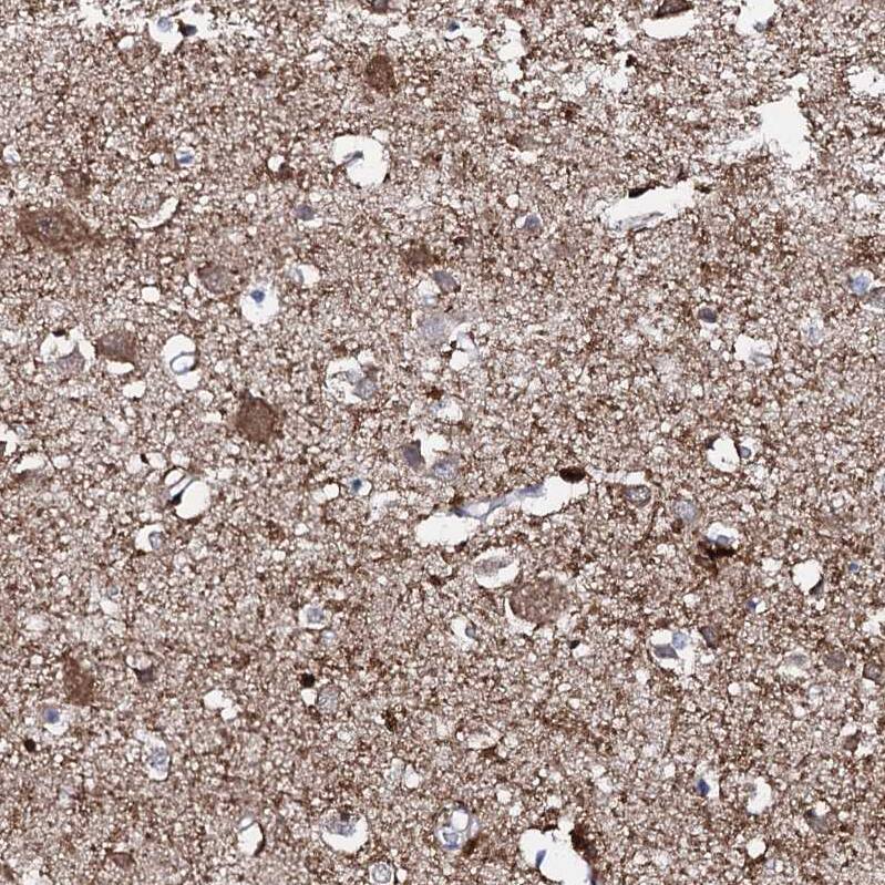 FAM123A Antibody - BSA Free Immunohistochemistry: FAM123A Antibody - BSA Free [NBP1-93907]